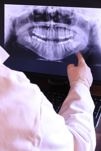 Best Emergency Root Canal Treatment in Port Angeles, WA