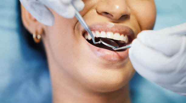 Best 24-Hour Emergency Dentist in Port Angeles, WA