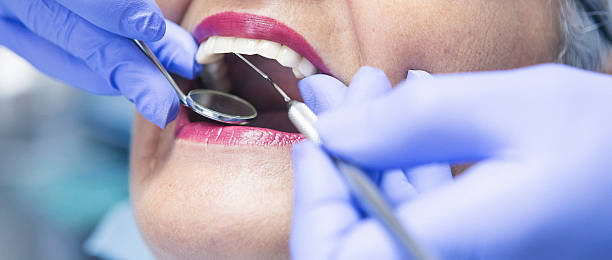 Best Broken or Cracked Tooth Emergency Dentist in Port Angeles, WA